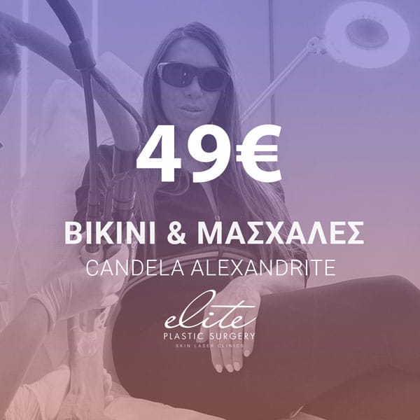 bikini-masxales-49